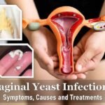 Understanding Fibroids & Cysts: Natural Relief Is Possible