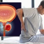 Prostate Problems & Erectile Dysfunction? Break the silence!!!